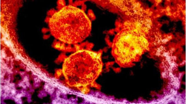Chandipura virus kills 22 in Gujarat what is this new pandemic