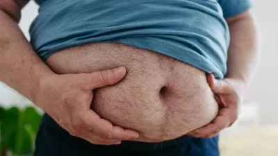 Belly Fat - Losing weight but not belly fat know these 7 reasons