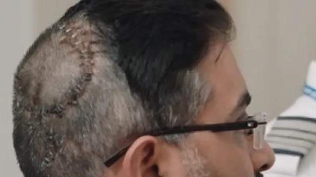 Captain Smith Machar head injury photo shared by AP BJP