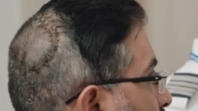 Captain Smith Machar head injury photo shared by AP BJP