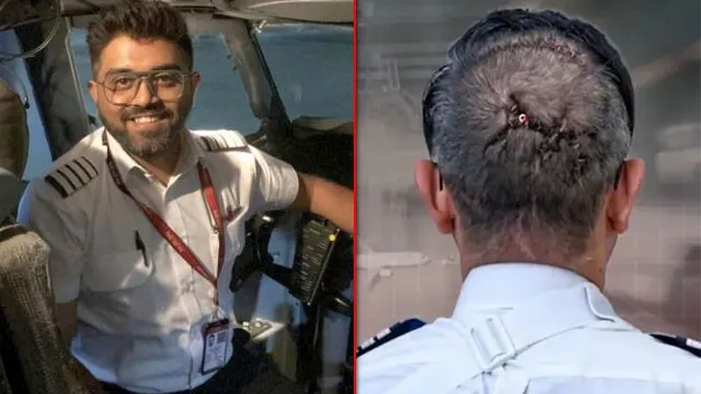 Smith Matcher survived death twice after pilot axe attack as shocking facts emerge
