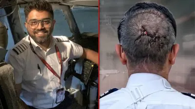 Smith Matcher survived death twice after pilot axe attack as shocking facts emerge