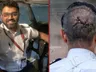 Smith Matcher survived death twice after pilot axe attack as shocking facts emerge