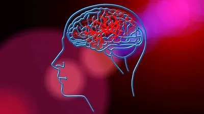 NIMHANS study reveals link between Vitamin B6 and stroke risk in youth